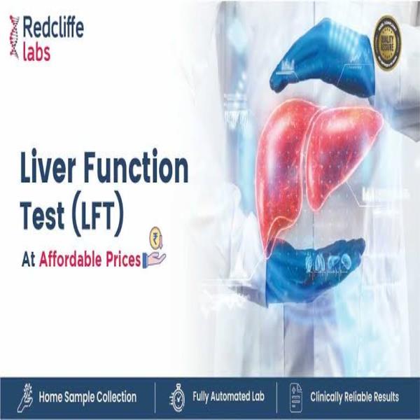 Liver Function Test (LFT)