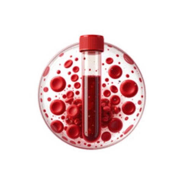 Complete Blood Test (CBC)